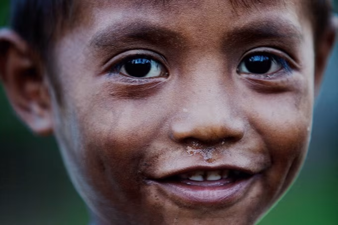 Timor-Leste vertraulich